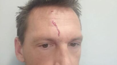 SKANDAL: Napadnut legendarni srpski veslač, poznato i ko ga je udarao! (FOTO)