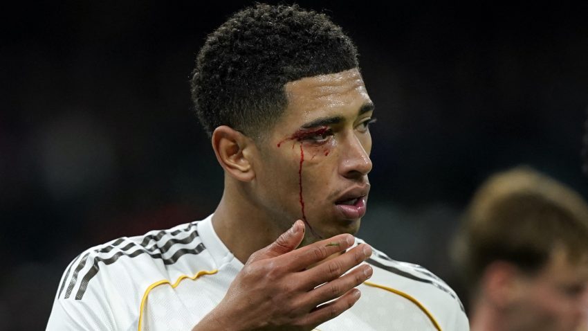 Real krvari: Bernabeu čeka odgovor