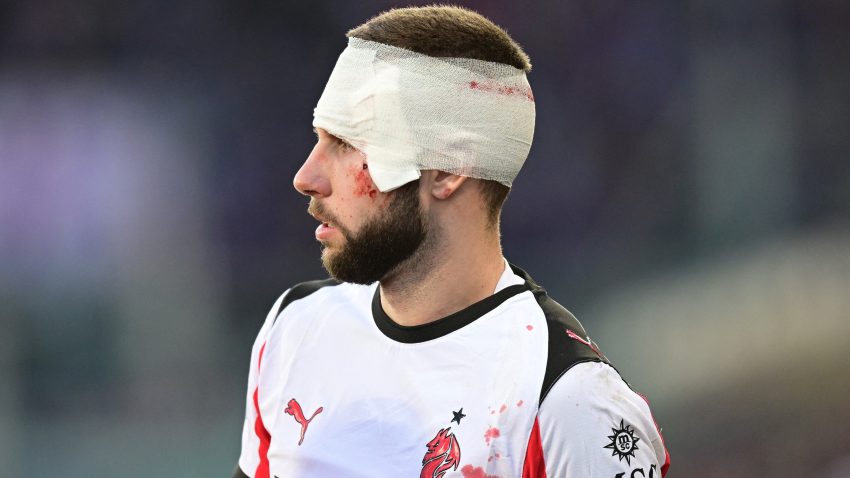Direktno u bolnicu posle sudara: Pavlović zaradio devet šavova